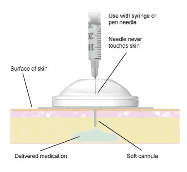 i-Port Advance™ Injection Port | MiniMed