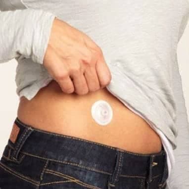 Person showing the i-Port Advance adhesive port worn on their abdomen