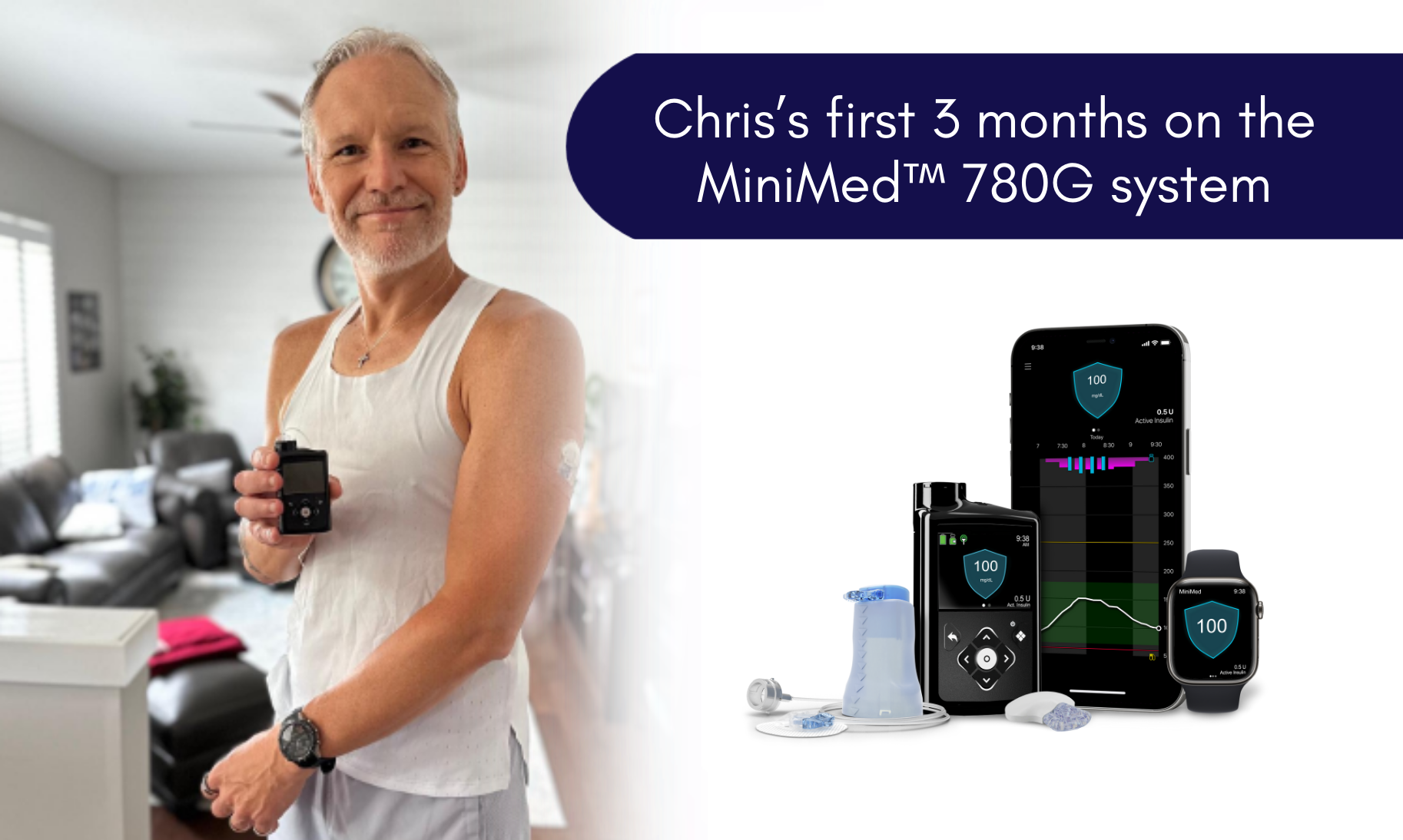 blog-minimed-champion-Chris-780g-review