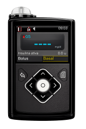 640g insulin pump