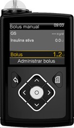 640g insulin pump