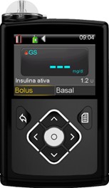 640g insulin pump