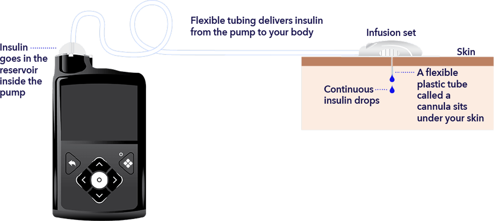 How pump works diagram