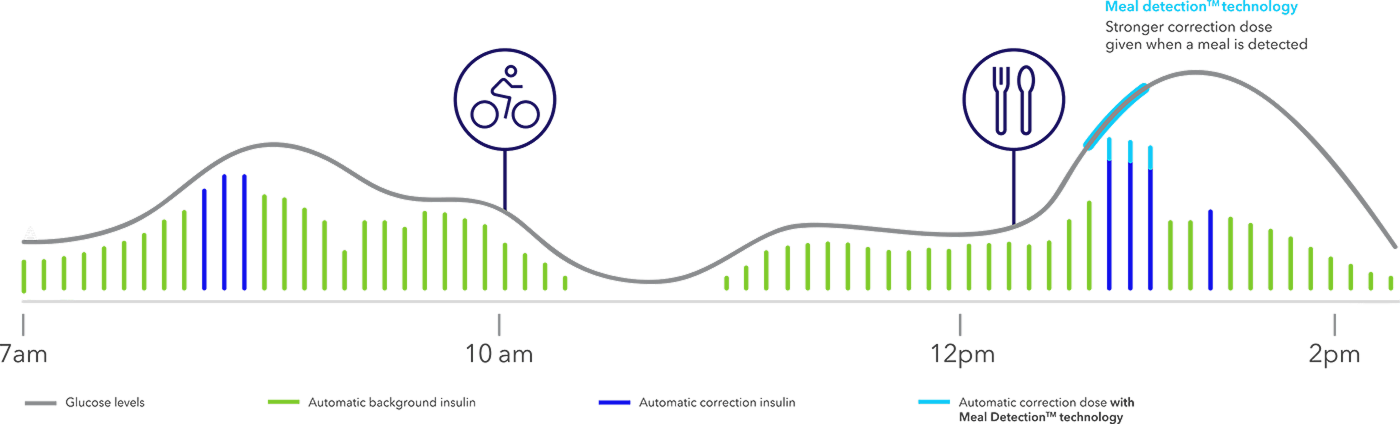 US Auto basal and auto correction chart