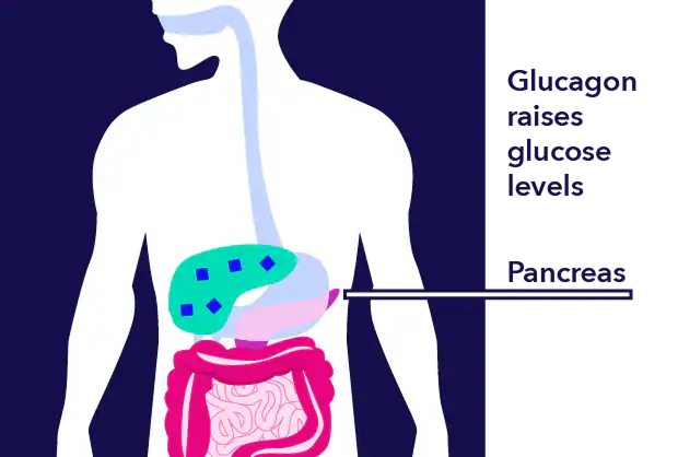 Diabetes illustration