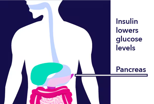 Diabetes illustration