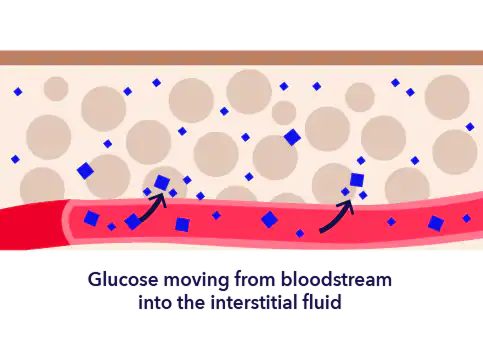 Diabetes illustrationglucose moving from bloodstream into the interstitial fluid