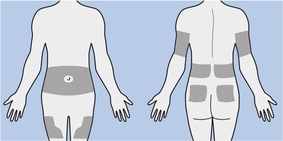 Diagram of adult insertion sites on the body