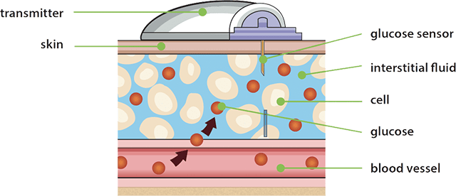 sensor-glucose-blood-glucose-diagram