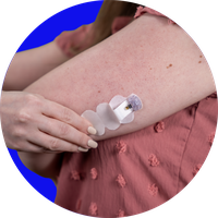 Person inserting an infusion set into the back of the upper arm.