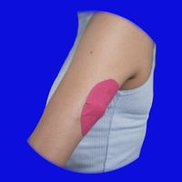 Illustration highlighting the recommended upper arm infusion set placement area.
