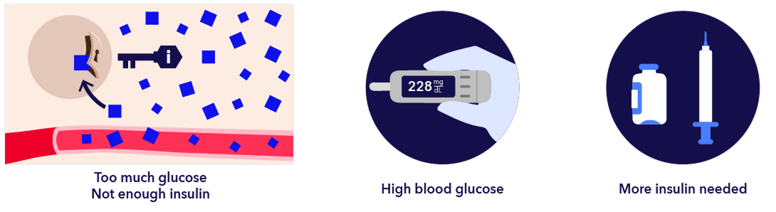 symptoms hyperglycemia too much glucose, high blood glucose, more insulin needed