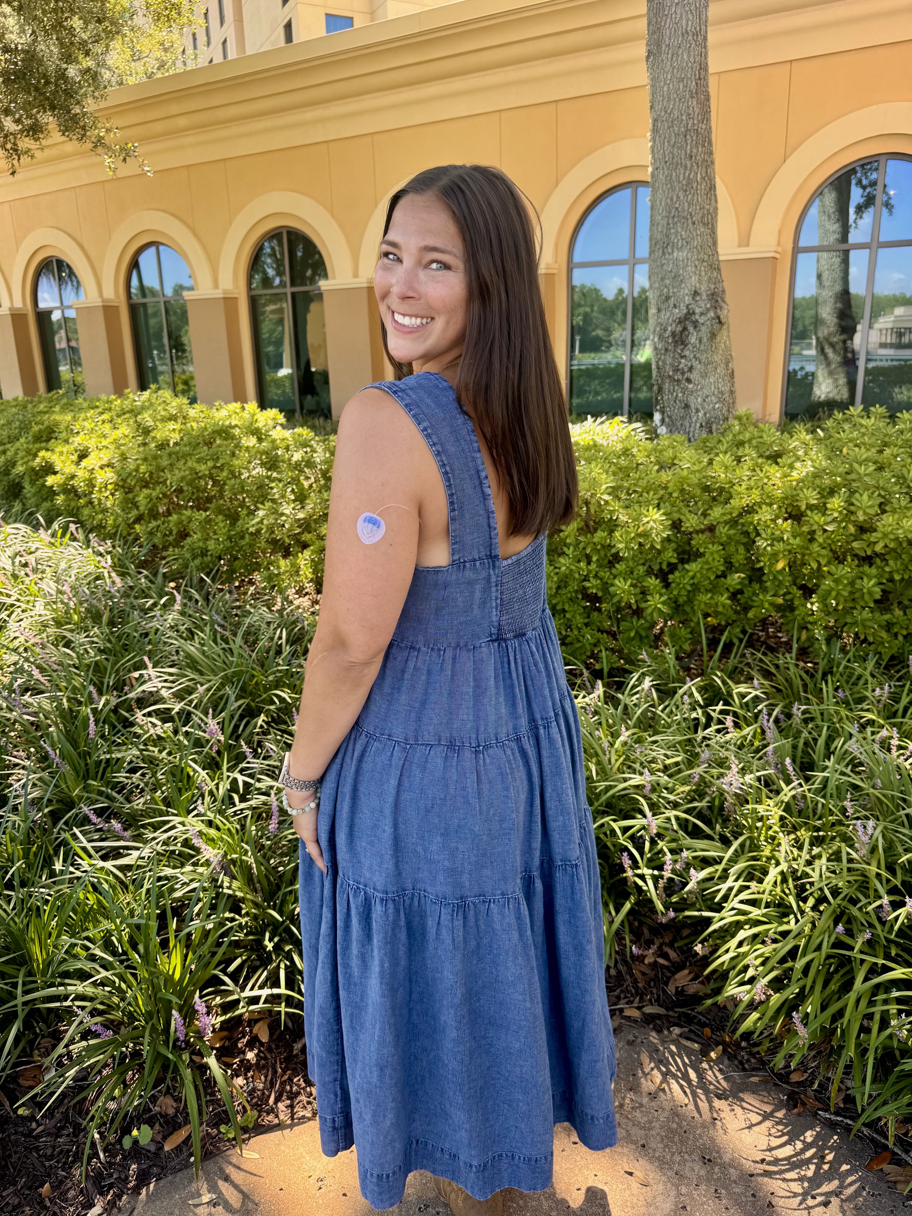 Emily in a dress with Extended Infusion set on back of arm