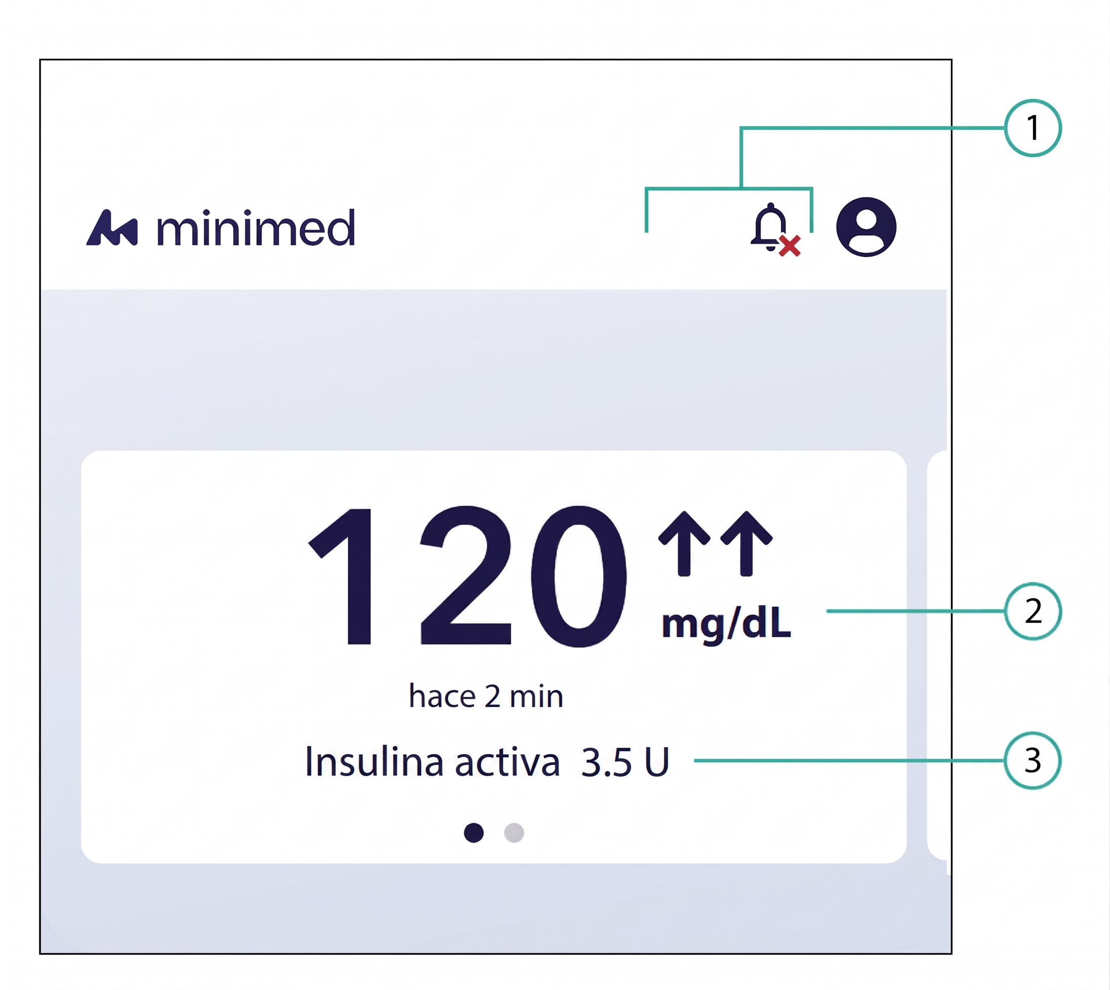 Gráfico de la pantalla del sensor Flex en modo SmartGuard