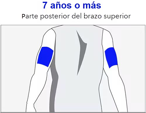 Gráfico del sitio de inserción del sensor G4