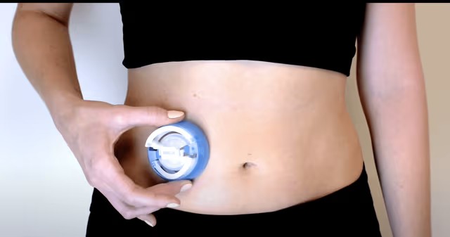 i-Port on the abdomen