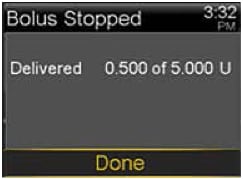 pump-630g-bolus-stopped-screen-done-selected