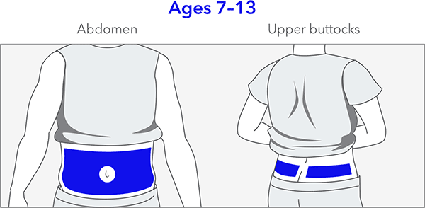 pump-780g-insertion-site-diagram-1