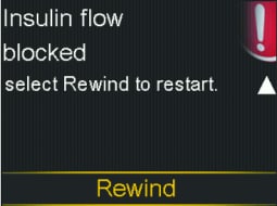 pump-780g-insulin-flow-blocked-screen-rewind-selected