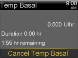 pump-780g-settings-temp-basal-cancel-temp-basal
